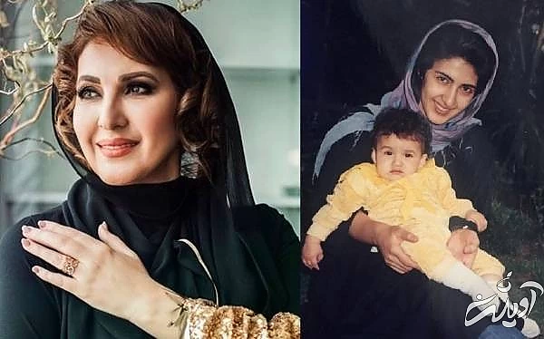 تغییرات چهره فاطمه گودرزی  فاطمه گودرزی